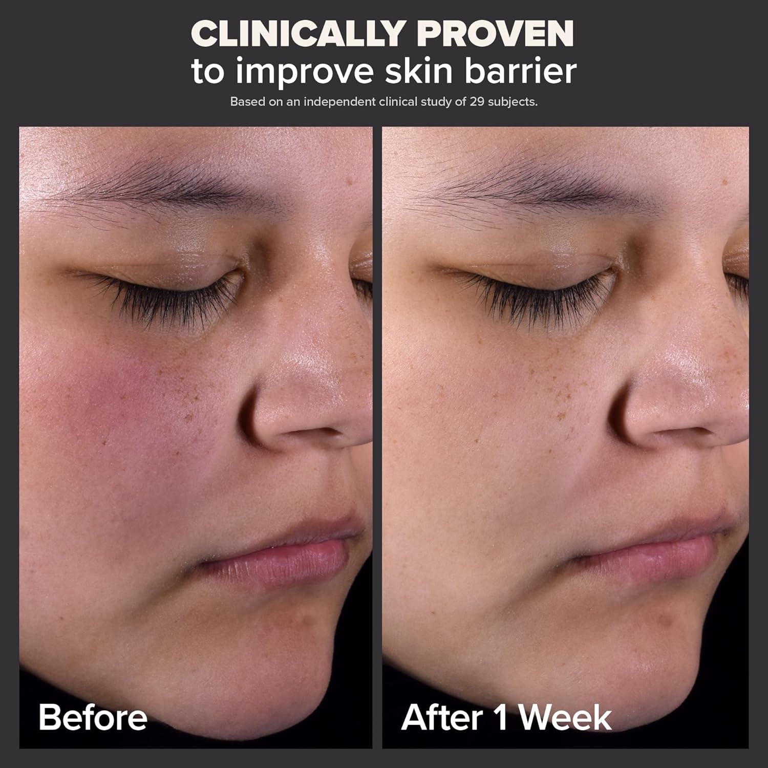Paulas Choice--SKIN PERFECTING 2% BHA Liquid Salicylic Acid Exfoliant--Facial Exfoliant for Blackheads, Enlarged Pores, Wrinkles  Fine Lines, 4 oz Bottle