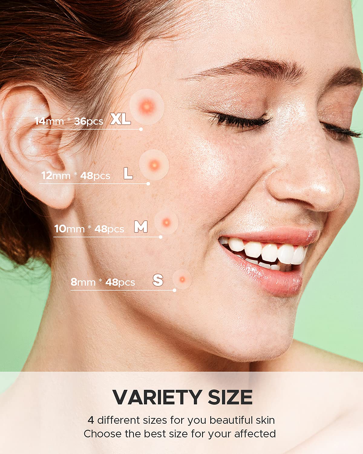Acne Pimple Patch Review
