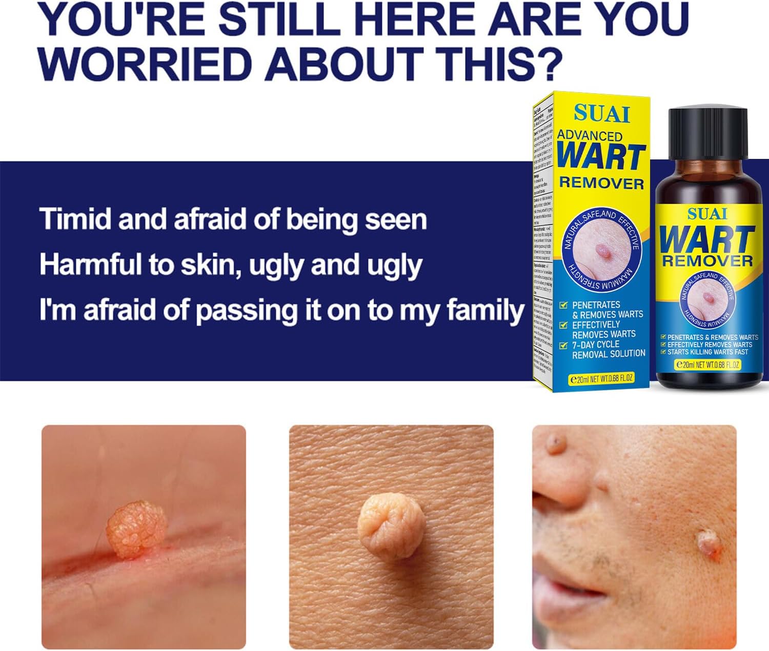 Liquid Wart  Corn Gel Maximum Strength Wart  Corn Liquid Mask, Exclusive Formula Wart Gel Corn mask for Quickly Removing Plantar Warts, Common Warts and Warts of Hands and feet