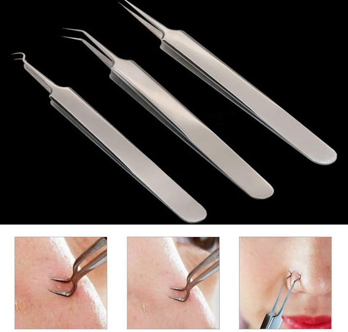 Stainless Steel Blackhead Remover Kit Bend Curved Hook Oblique Straight Clip Tweezer Blemish Extractor Tool for Remove Comedones Whitehead Blackhead Acne Pimple