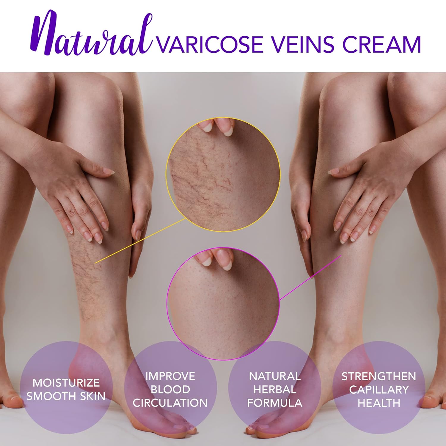 Varicose Vein Cream for Legs - Improves Blood Circulation, Reduces Spider Veins and Heaviness, 2 Oz