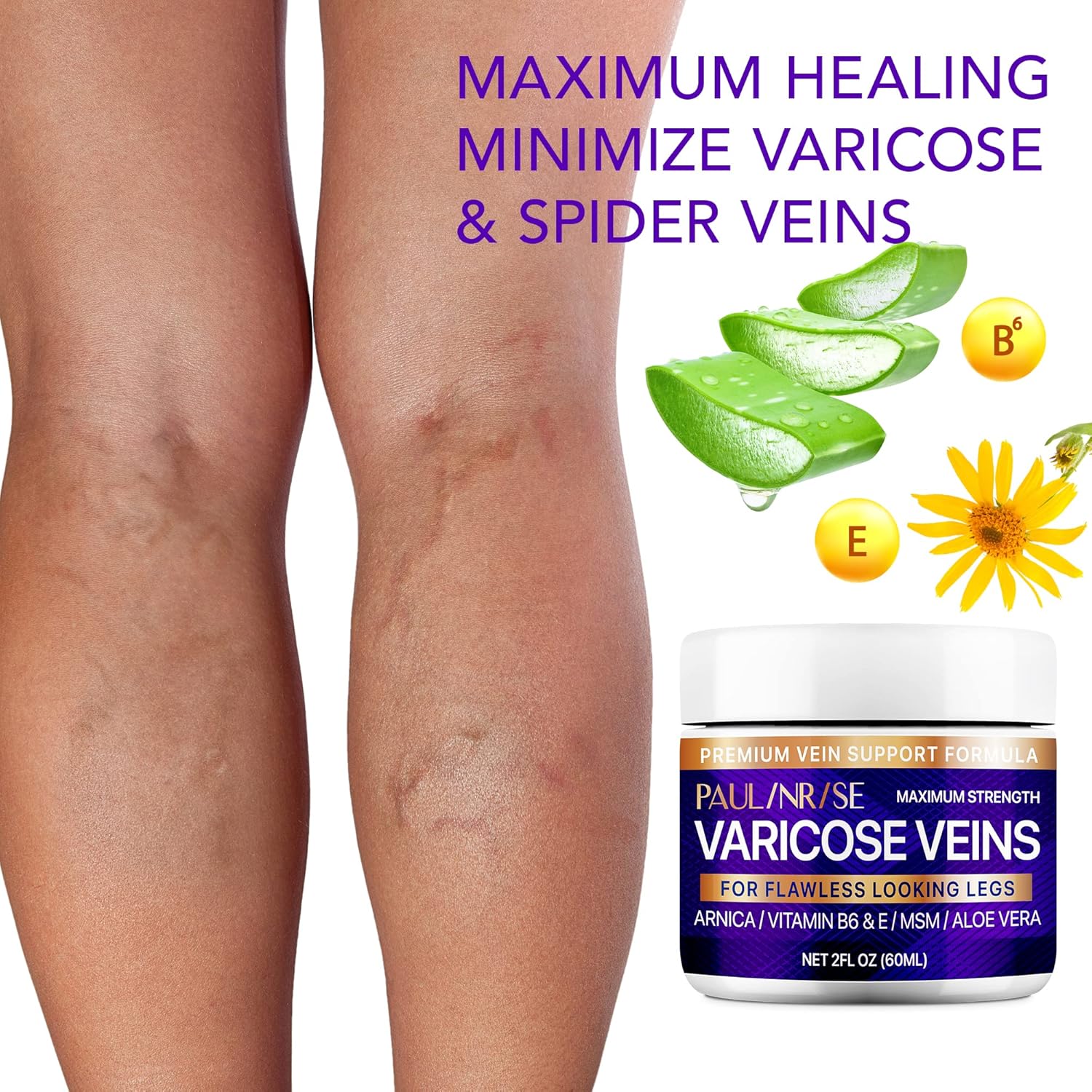 Varicose Vein Cream for Legs - Improves Blood Circulation, Reduces Spider Veins and Heaviness, 2 Oz